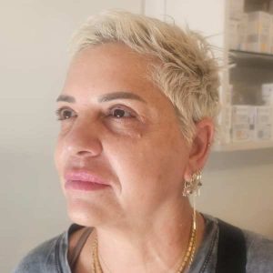 טיפול פנים אנטי אייג'ינג לפני טיפול