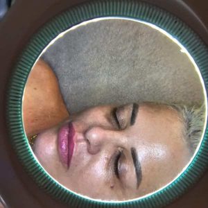 צילום פנים לאחר טיפול אנטי אייג'נג